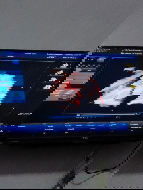 usg Di kehamilan 25wek