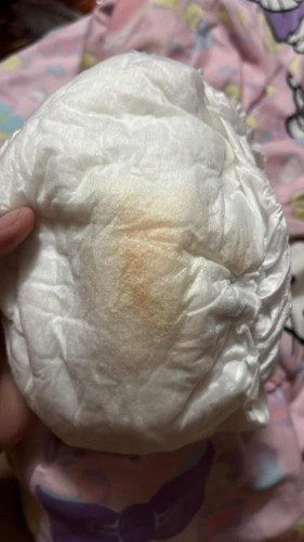 ฉี่ลูกสาวเป็นสีส้มผิดปกติไหมคะ