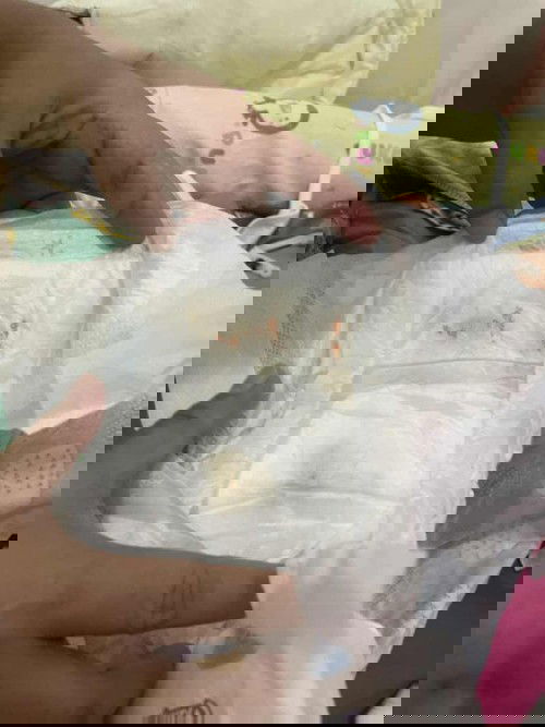 Keliar bercak merah saat pipis