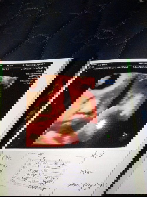 Usia kehamilan 37week