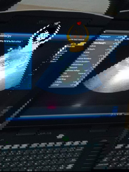 Jenis kelamin kelihatan kira' Minggu keberapa y bun