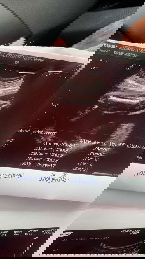 สอบถามหน่อยค่ะเเม่ๆ