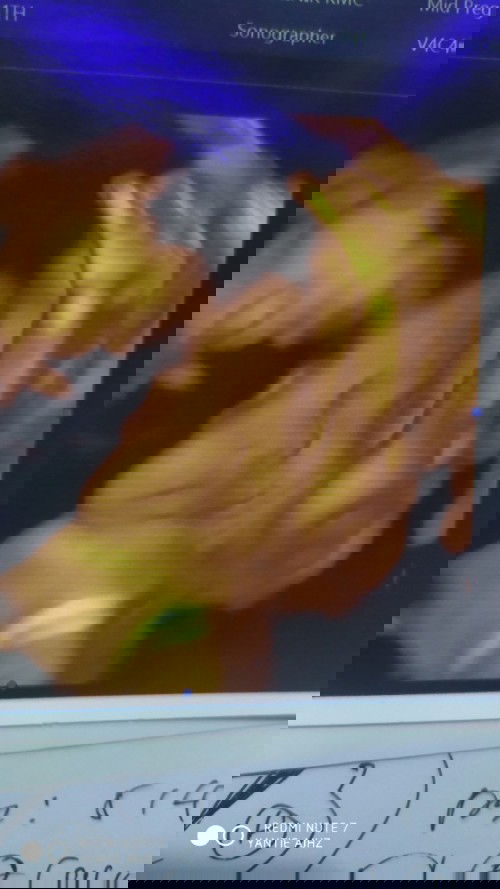 USG 2d dulu atau langsung 4d