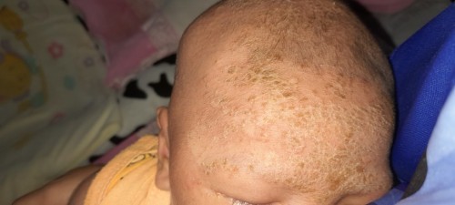 น้อง1เดือน5วัน