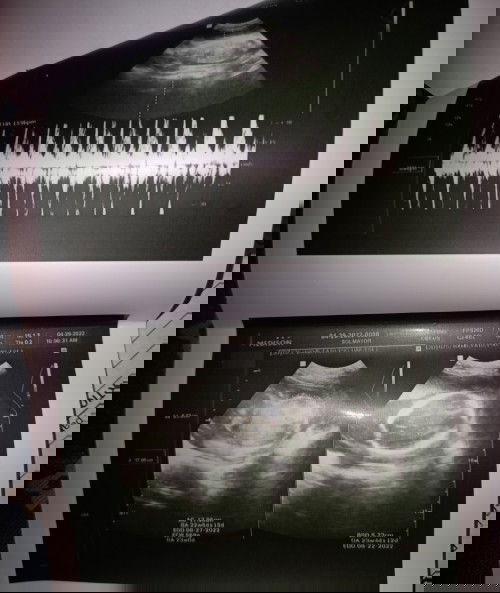 sure na po kaya na baby boy po ito?