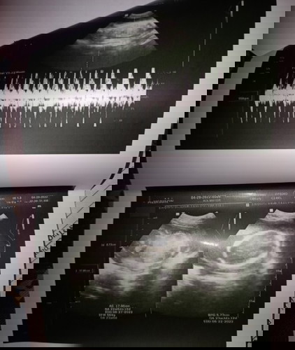 sure na po kaya na baby boy po ito?