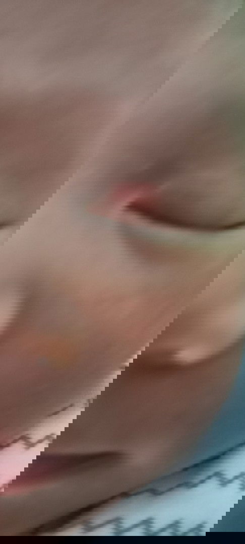 Merah pada kelopak mata