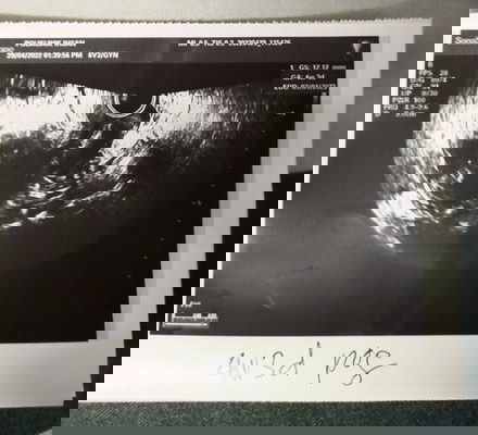 Mohon doa kalian 🤲💓