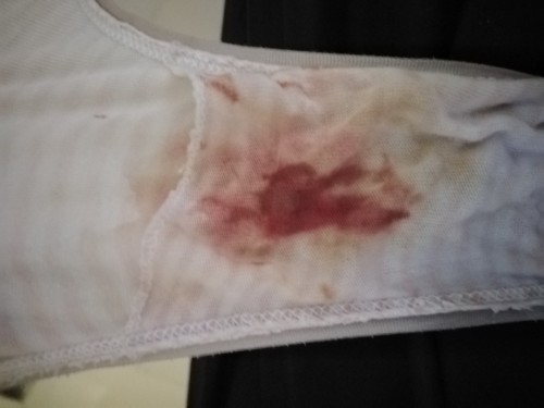 Pregnant for more than 4 weeks