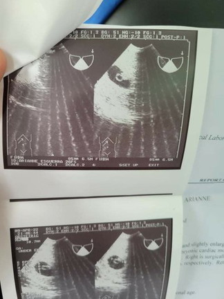 First baby