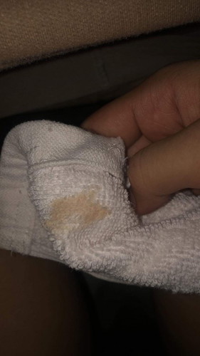 มีเลือกผสมตกขาว