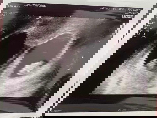 Twins มาแพคคู่