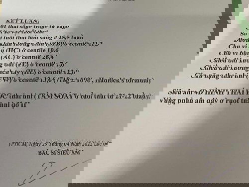 Cân nặng thai nhi