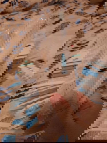 Kehamilan dengan Anti Phospolipid Syndrome (Pengentalan Darah) part 2