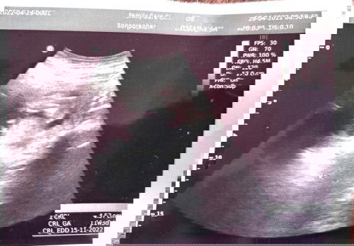 Scan 7W3d, rupanya 11w3d