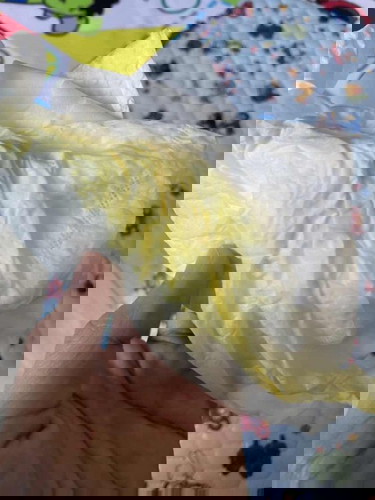 น้องแหวะนมเป็นสีเหลือง