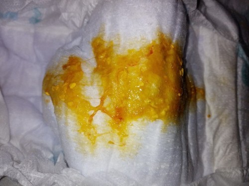 Hi mommies, first time baby saya berak taik nmpak macam ada spot darah? Kenapa ehh? Baby bf je