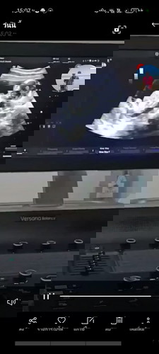 อยากได้ลูกสาว😅