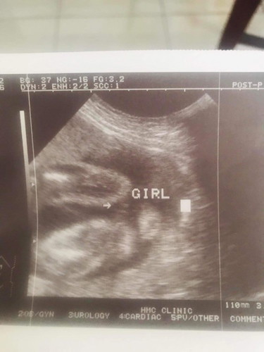 Final gender of baby