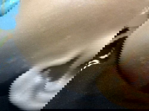 Bintik/ bercak putih pada anak