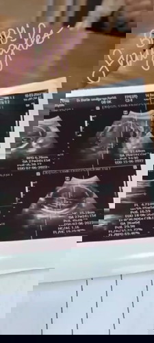 Mau nanyak Bun ini hasil USG brp D ya?