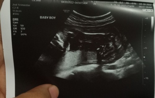 Third Baby (Boy)