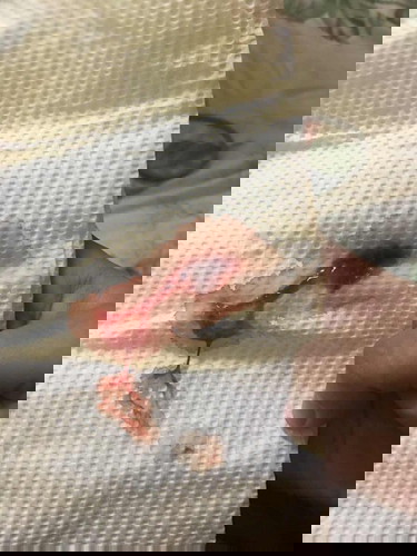 Nagdischarge po ako ng ganito.