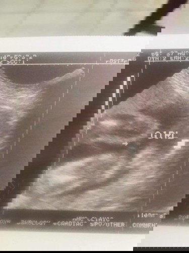Baby's gender
