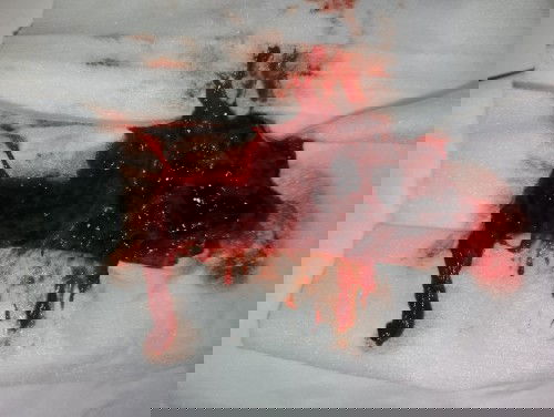 ก้อนเลือดแบบนี้ออกมาหลังคลอดลูกได้17วันเป็นอะไรมั้ยคะหรือตกเลือด