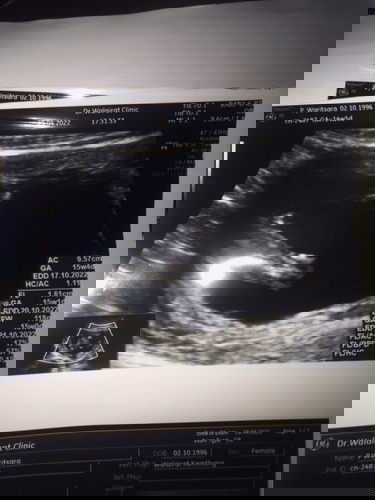 แม่ๆช่วยดูผลอัลตร้าซาวด์หน่อยค่ะ