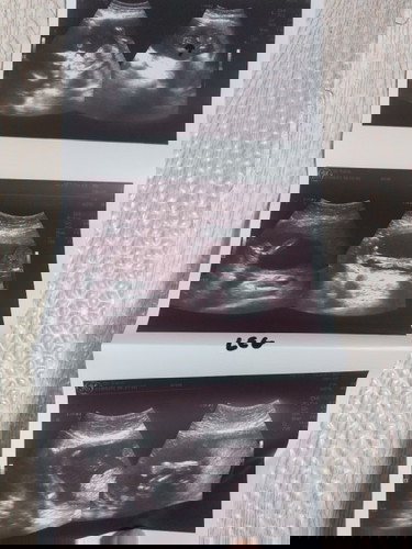 ขอดูของแม่ๆน่อยค่ะ