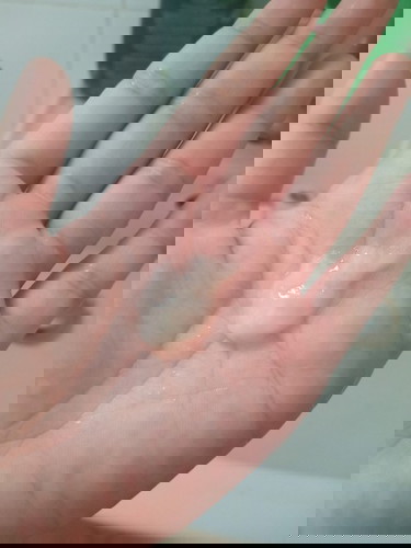 มูกขาว ตกขาว