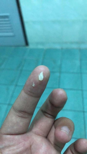 อันนี้เรียกมูกรึเปล่าค่ะ