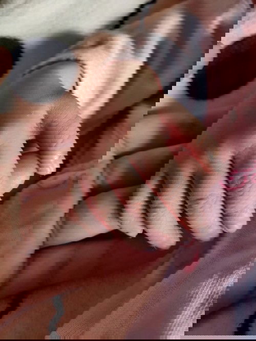 Emergency CS April 11