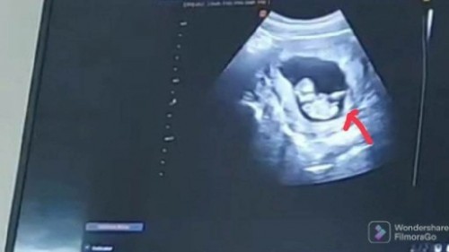 เพศไหนดีน้าาา ช หรือ ญ