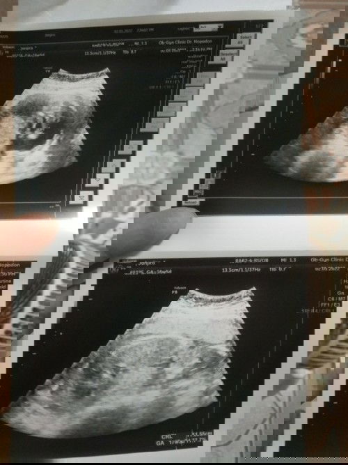 แม่ๆทีมตุลารู้เพศลูกกันหรือยังคะ