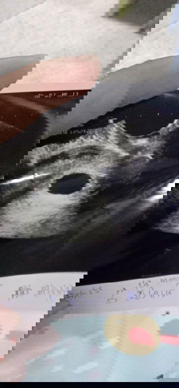 นับปจด9วีค คุณหมอนับ6วีค