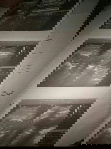 ano pobang gender nya