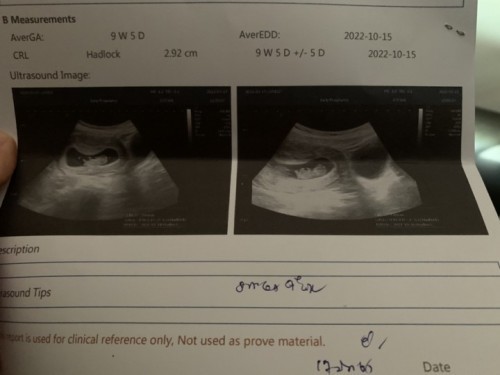 ได้เจอกันแล้วนะลูก 👶🏻🤍