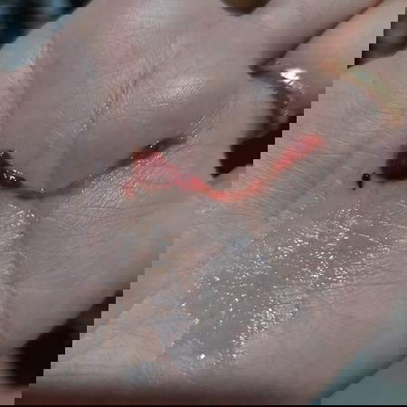 1 week bleeding- 6 weeks pregnant