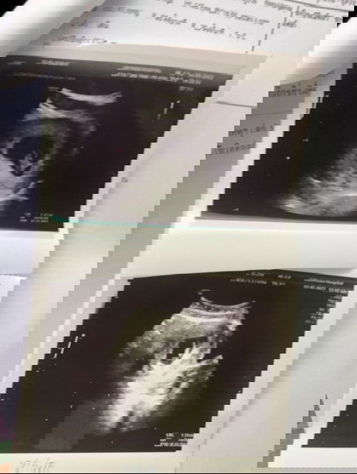 ดีใจมากเลยค่ะ 🥰👶🏻