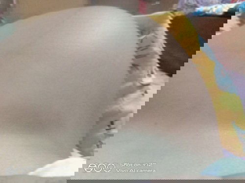 ท้อง37+1
มีอาการเจ็บท้องด้านบนขวา เจ็บจื๊ดๆนอนก็เจ็บนั่งก็เจ็บแม่ๆบ้านไหนเคยเป็นไหมค่ะ