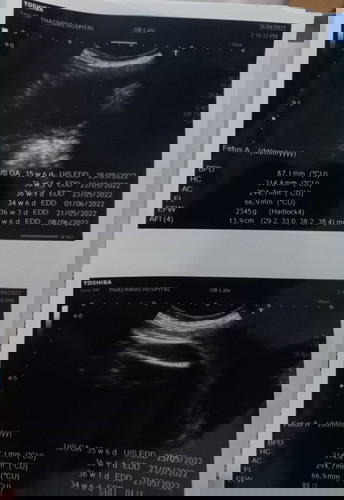 สวัสดีค่ะ พี่ๆพอดูออกมั้ยค่ะว่าน้องเป็นผู้ชายหรือผู้หญิง 😁ตอนนี้37w3D ซาวน้องแล้วขาน้องบัง