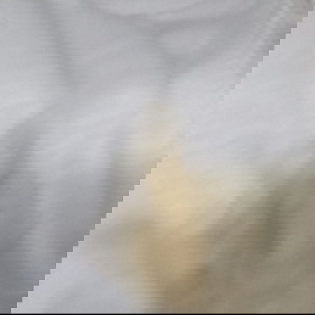 Yellow discharge