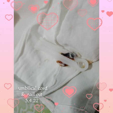 umbilical cord