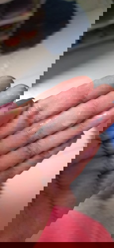 Ketuban atau keputihan??