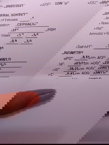 Ask lang po ako pag cephalic po ba naka lagay is ma normal delivery po ba ?