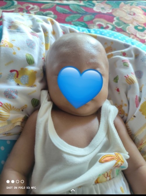 Jidat bayi