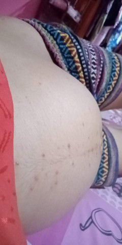 แม่ๆคนไหนเป็นบ้างค่ะ