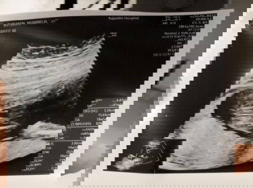 สอบถามน่อยค้า❤️